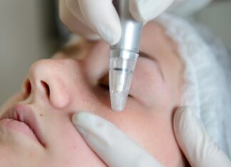 Co lepsze mikrodermabrazja czy mezoterapia?